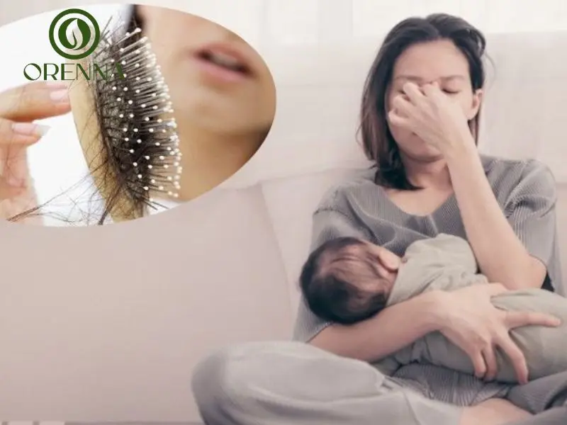 rụng tóc sau sinh