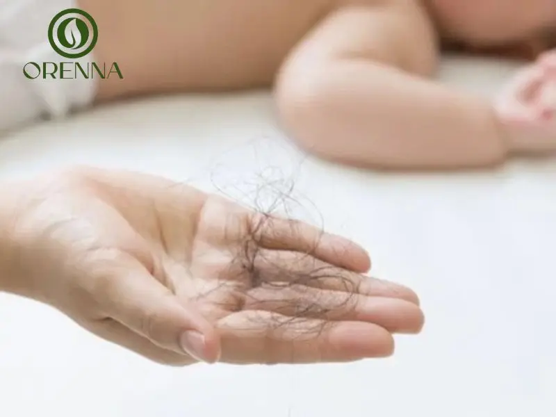 Cách khắc phục và chăm sóc tóc rụng sau sinh hiệu quả