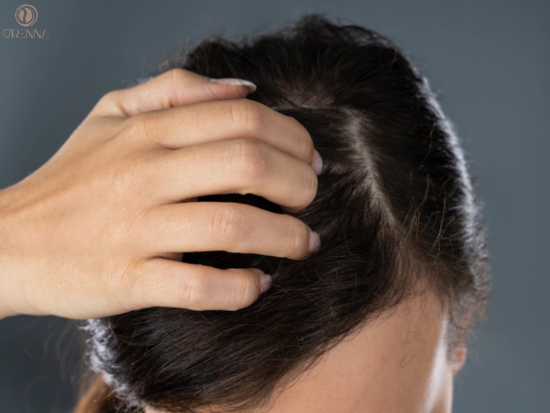 Các phương pháp hỗ trợ giảm ngứa da đầu hiệu quả