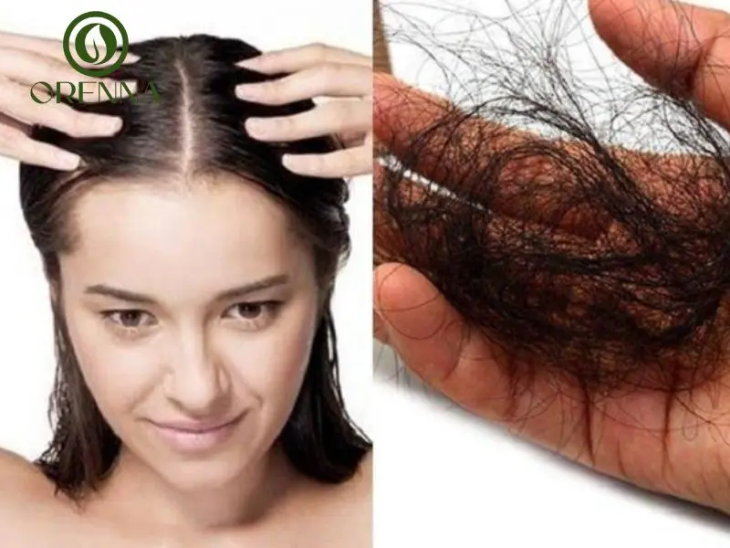 Cách khắc phục tình trạng rụng tóc nhiều ở nữ