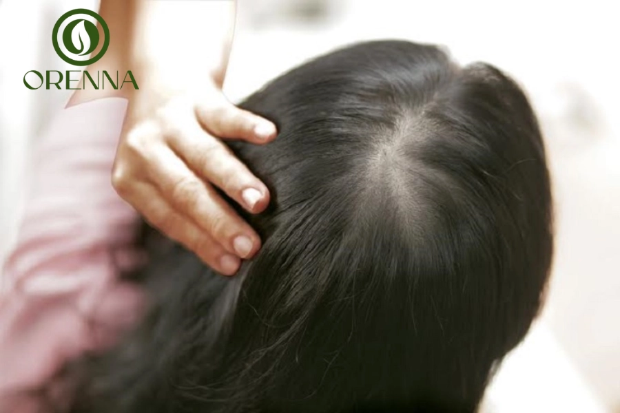 Bị Hói Ở Đỉnh Đầu Nữ: Nguyên Nhân, Dấu Hiệu Và Cách Khắc Phục Hiệu Quả
