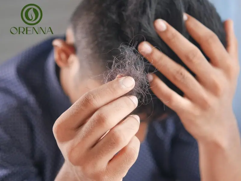 nguyên nhân rụng tóc ở nam