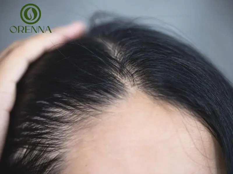 tóc mỏng