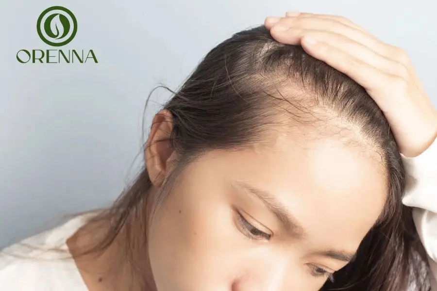 Nguyên Nhân Rụng Tóc Nhiều Ở Nữ Và Cách Khắc Phục Hiệu Quả 