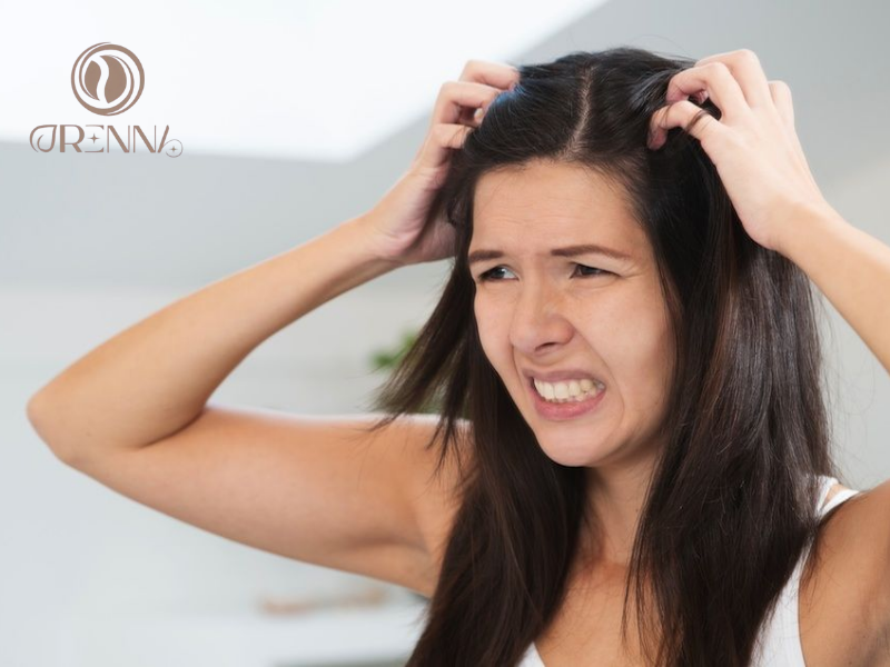 Sai lầm phổ biến khiến mảng gàu nặng hơn