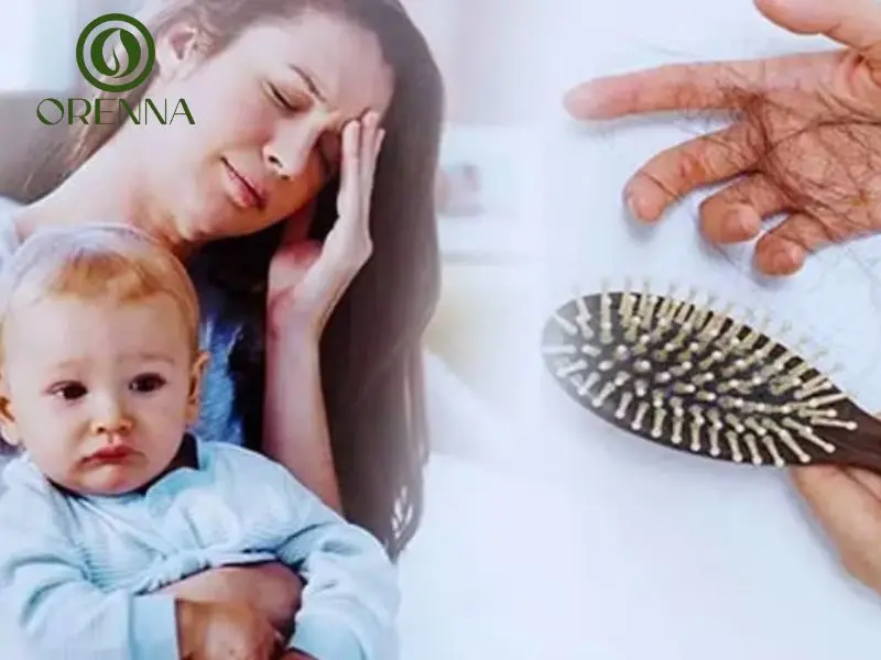 rụng tóc sau sinh