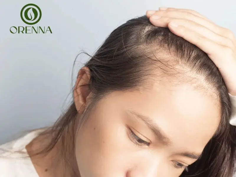 rụng tóc nhiều ở nữ