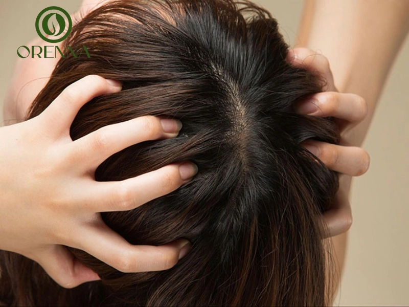 Massage da đầu và sử dụng tinh dầu để giảm nguy cơ bị hói