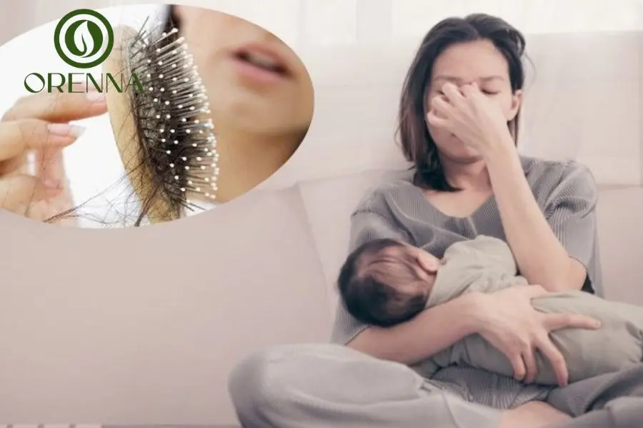 Cách Trị Rụng Tóc Sau Sinh An Toàn Hiệu Quả Tại Nhà